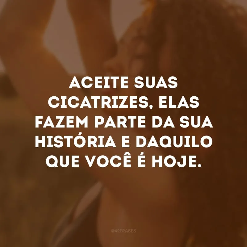 Aceite suas cicatrizes, elas fazem parte da sua história e daquilo que você é hoje.