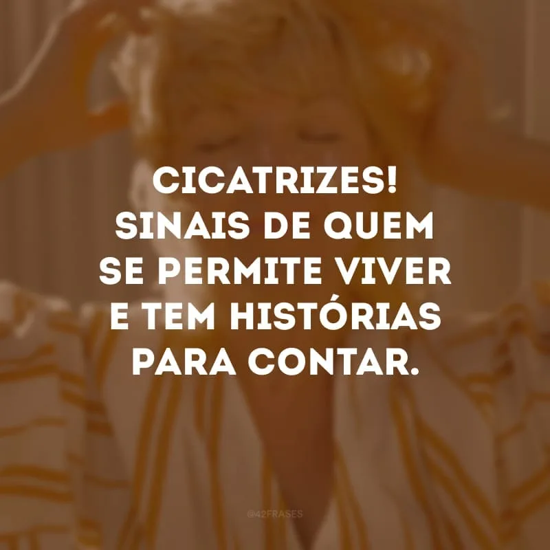 Cicatrizes! Sinais de quem se permite viver e tem histórias para contar.