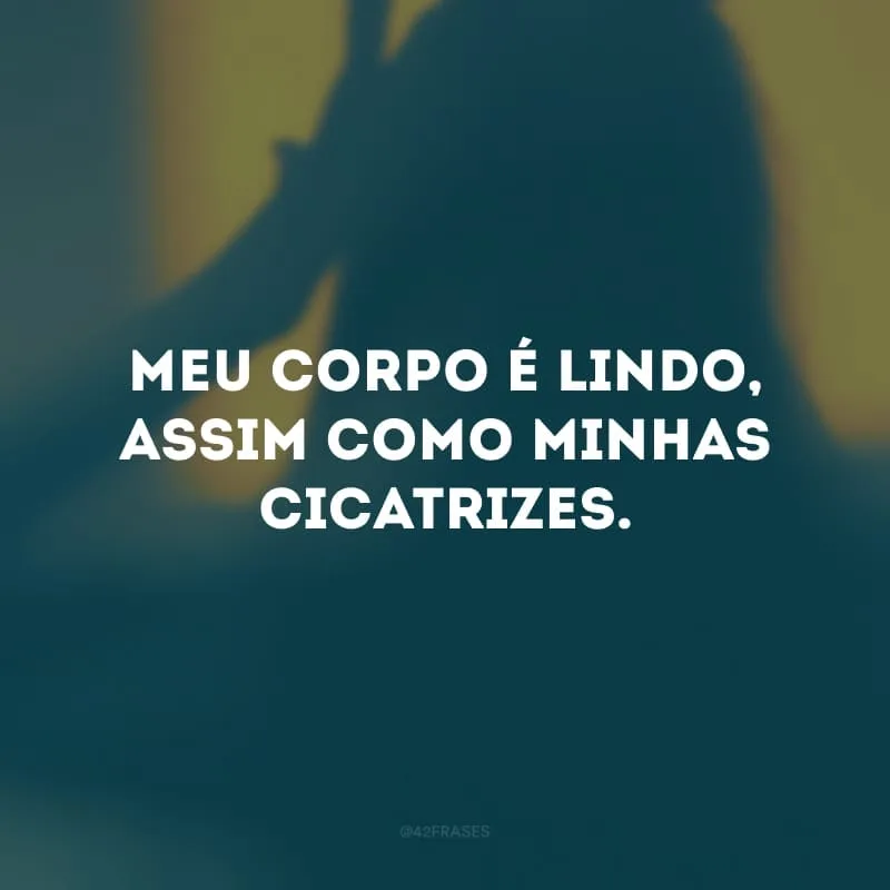 Meu corpo é lindo, assim como minhas cicatrizes. 
