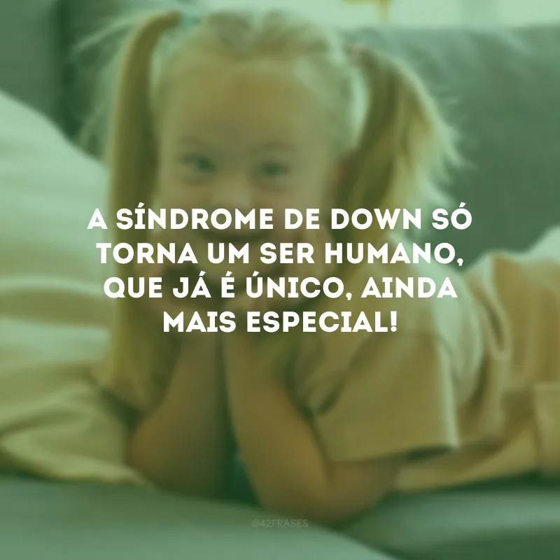 A Síndrome de Down só torna um ser humano, que já é único, ainda mais especial!