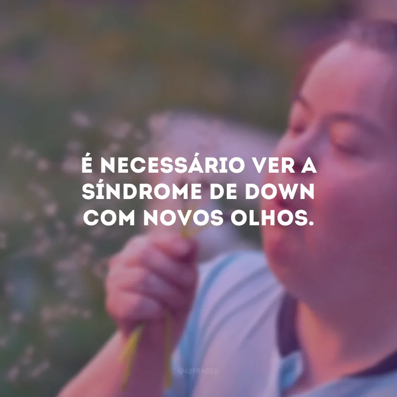 É necessário ver a Síndrome de Down com novos olhos.