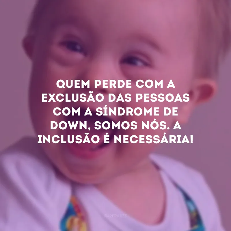 Quem perde com a exclusão das pessoas com a Síndrome de Down, somos nós. A inclusão é necessária!