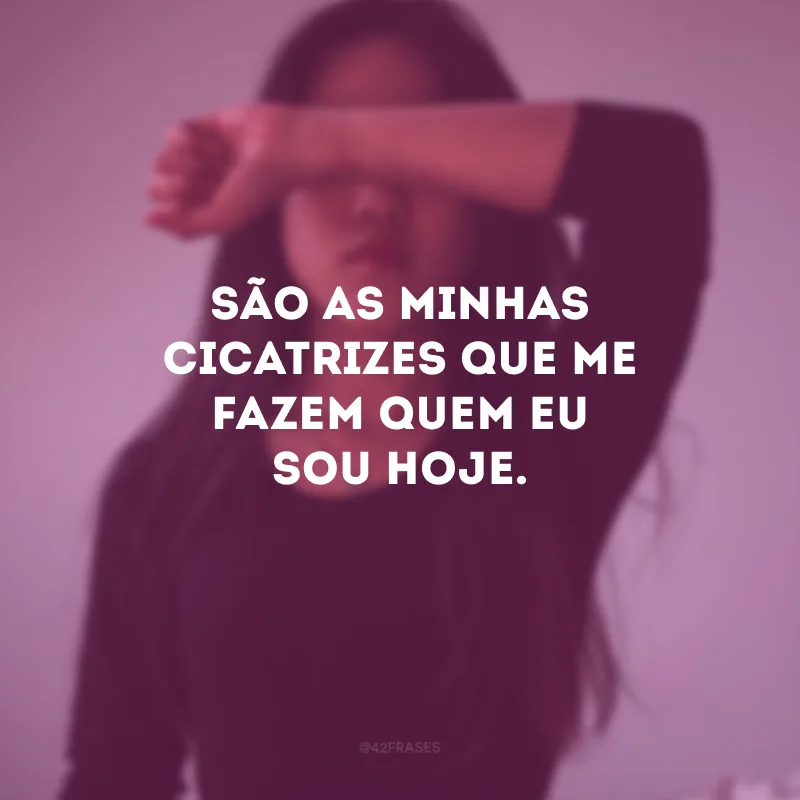 São as minhas cicatrizes que me fazem quem eu sou hoje.