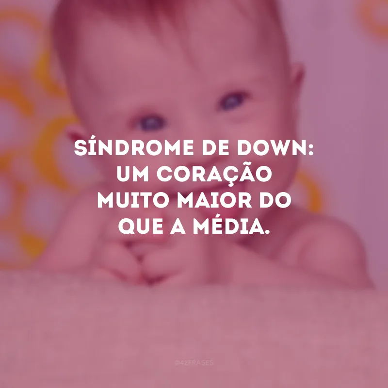 Síndrome de Down: um coração muito maior do que a média.